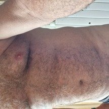 chrl1